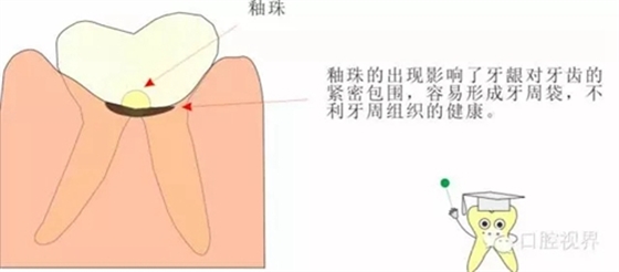 【愛牙科普知識300問】 “什么是融合牙、愈合牙和雙生牙？”