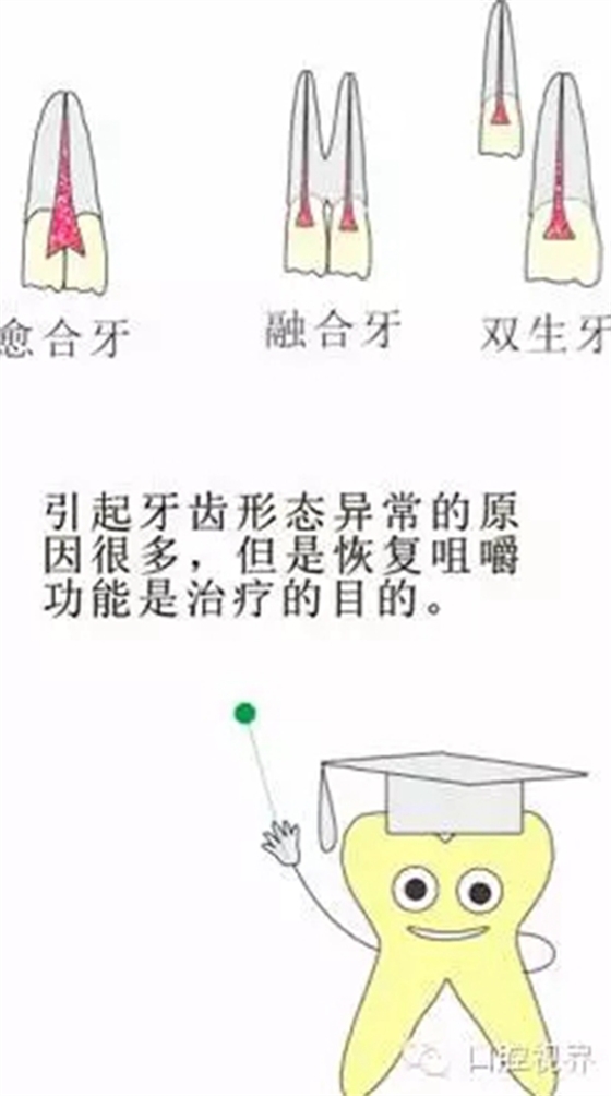 【愛牙科普知識300問】 “什么是融合牙、愈合牙和雙生牙？”