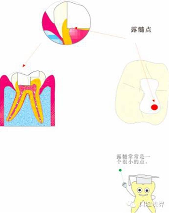 【愛牙科普知識300問】 “什么是融合牙、愈合牙和雙生牙？”