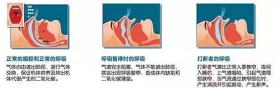 3.webp.jpg 3.webp.jpg