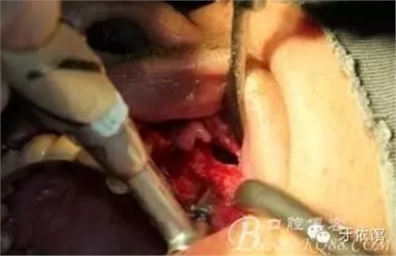 11.webp.jpg 11.webp.jpg