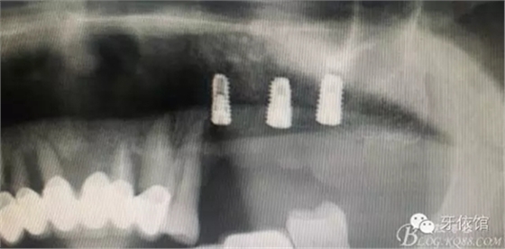 16.webp.jpg 16.webp.jpg