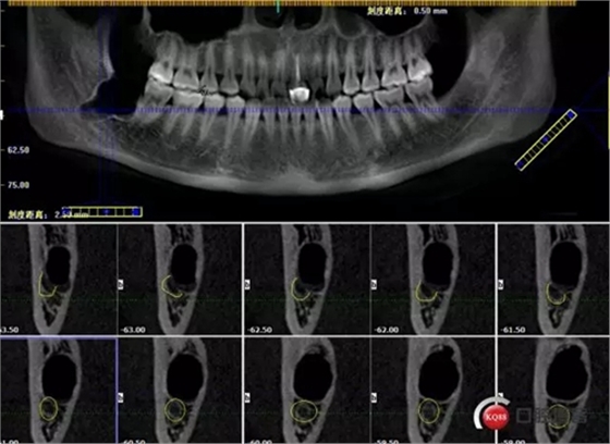 7.webp.jpg 7.webp.jpg