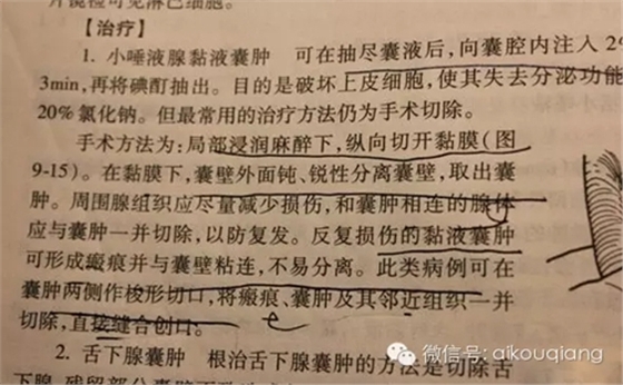 粘液腺囊腫 粘液腺囊腫