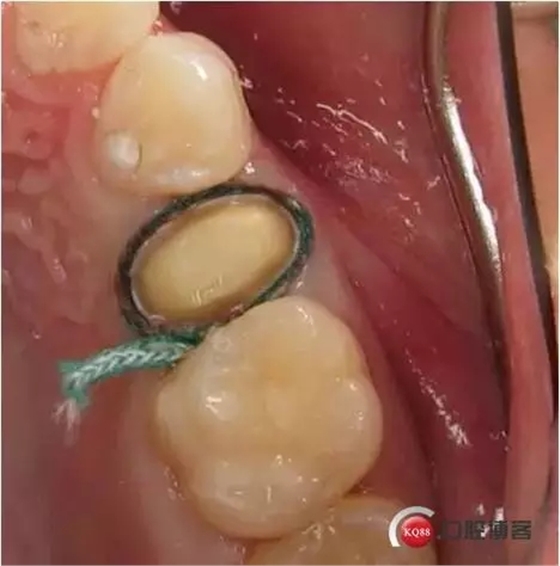 4.webp.jpg 4.webp.jpg