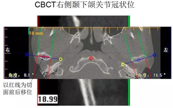 	口腔修復治療中，常見臨床接診流程