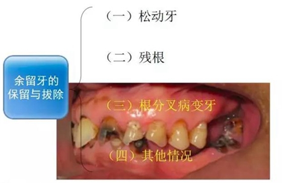 	口腔修復治療中，常見臨床接診流程