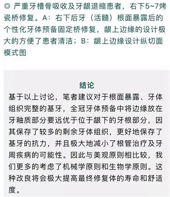做全冠修復時基牙根面暴露，如何備牙？