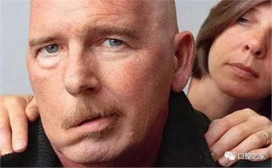 睡覺(jué)流口水怎么回事 睡覺(jué)流口水怎么回事