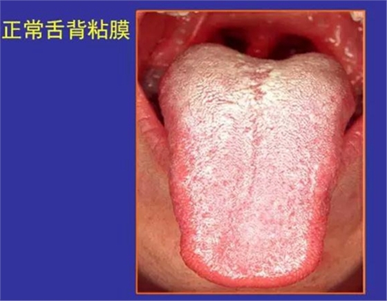 正?？谇火つぜ俺Ｒ姴p圖