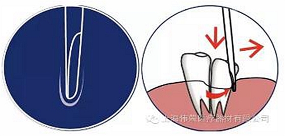 半/微創(chuàng)牙挺 半/微創(chuàng)牙挺