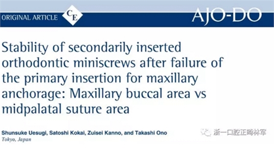 正畸文獻(xiàn)閱讀--上頜支抗初次植入失敗后二次植入穩(wěn)定性的研究 正畸文獻(xiàn)閱讀--上頜支抗初次植入失敗后二次植入穩(wěn)定性的研究
