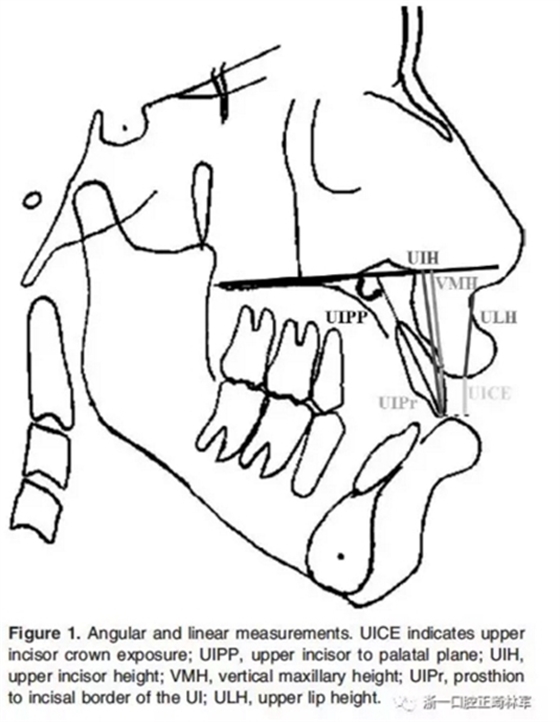 正畸文獻閱讀--在骨性II、III類開合中上中切牙牙冠暴露量的影響因素