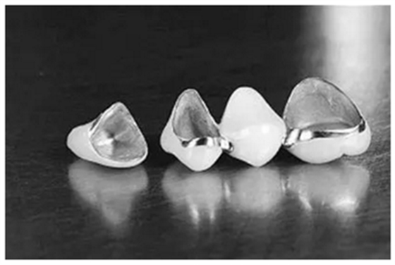 醫(yī)生，我的烤瓷牙上有個黑線怎么回事？