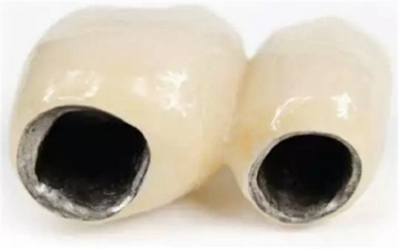 醫(yī)生，我的烤瓷牙上有個黑線怎么回事？