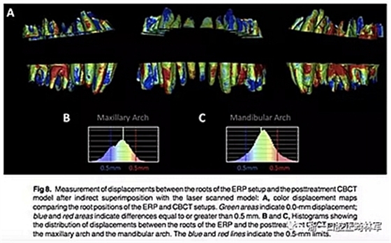 正畸文獻(xiàn)閱讀--正畸過程中牙根移動的三維監(jiān)測