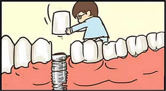 【牙齒種植】健康牙齒“種”出來 【牙齒種植】健康牙齒“種”出來