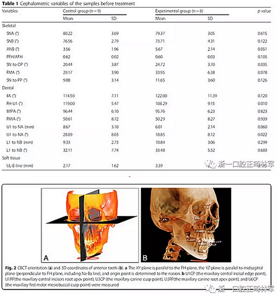 正畸文獻閱讀--用舌側(cè)滑動牽引系統(tǒng)控制前牙區(qū)段：初步的CBCT研究