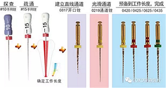 知識(shí)分享：根管治療的標(biāo)準(zhǔn)步驟