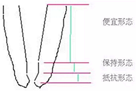 知識(shí)分享：根管治療的標(biāo)準(zhǔn)步驟