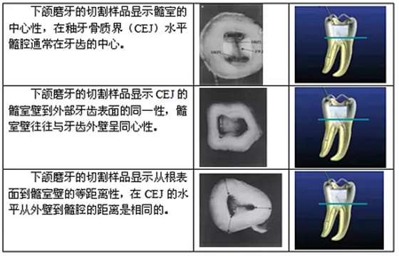 知識(shí)分享：根管治療的標(biāo)準(zhǔn)步驟