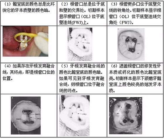 知識(shí)分享：根管治療的標(biāo)準(zhǔn)步驟