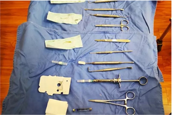 A當根管治療遇見根尖骨穿孔 A當根管治療遇見根尖骨穿孔