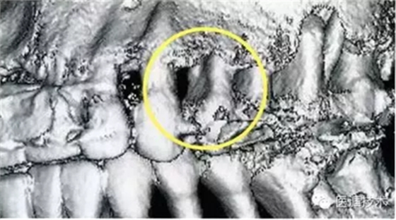 【牙周外科】牙齒的解剖形態(tài)（上篇）