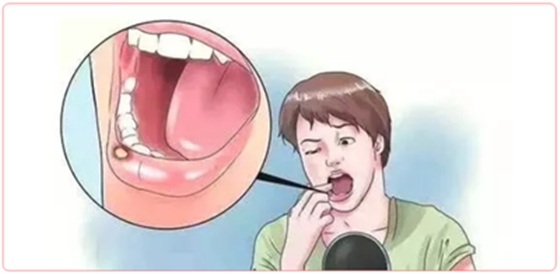 特殊時期為什么常規(guī)的口腔治療都不能做了？