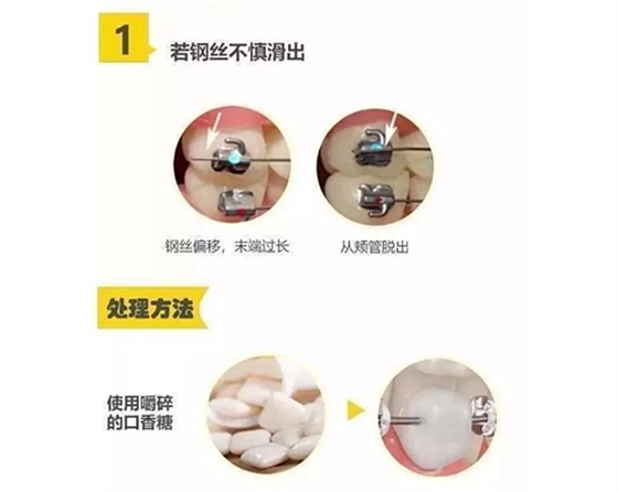 特殊時期為什么常規(guī)的口腔治療都不能做了？
