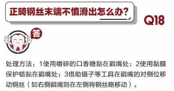 	 牙醫(yī)停診了？別怕，請您收下這份居家牙科急癥指南！