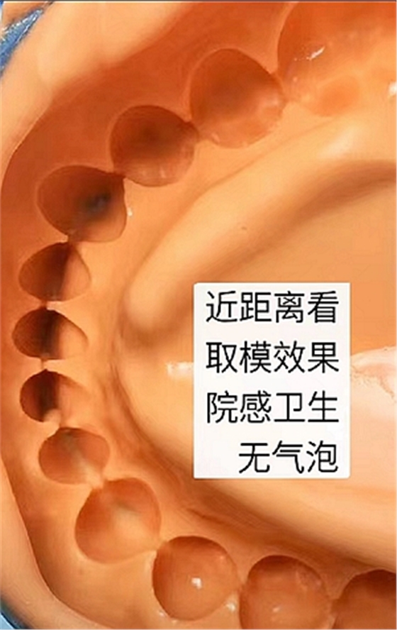 ?？抵Z德藻酸鹽印模材料