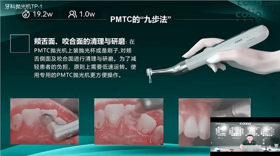 頰舌面、咬合面的清理與研磨