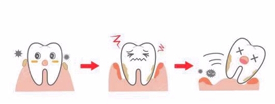 牙周病總是來(lái)勢(shì)洶洶？有辦法預(yù)防嗎？