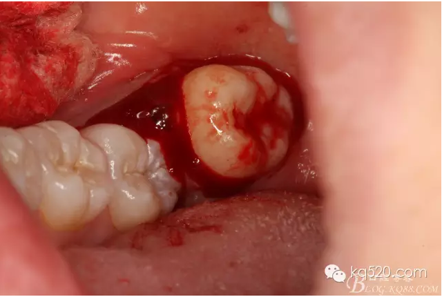 QQ圖片20150712143549.png QQ圖片20150712143549.png