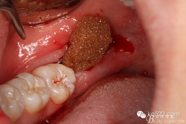 QQ圖片20150712143639.jpg QQ圖片20150712143639.jpg