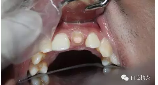 QQ圖片20150730112032.png QQ圖片20150730112032.png