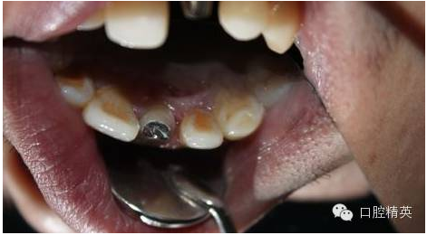 QQ圖片20150730112109.png QQ圖片20150730112109.png