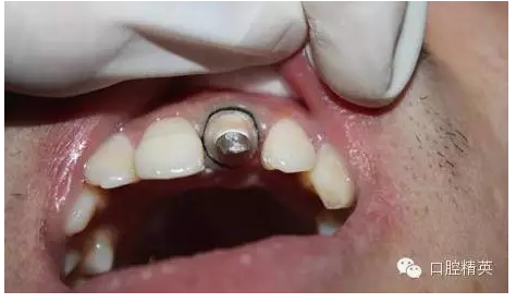 QQ圖片20150730112124.png QQ圖片20150730112124.png