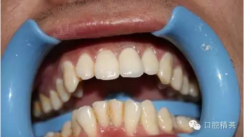 QQ圖片20150730113245.png QQ圖片20150730113245.png