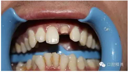 QQ圖片20150730113310.png QQ圖片20150730113310.png