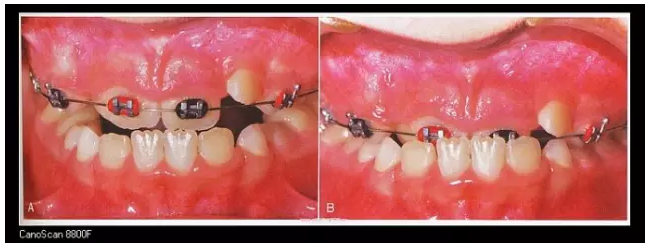 QQ圖片20150803115340.png QQ圖片20150803115340.png