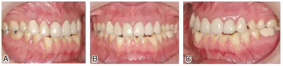 QQ圖片20150803123000.png QQ圖片20150803123000.png