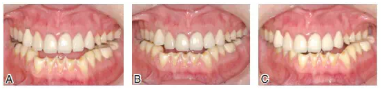 QQ圖片20150803123612.png QQ圖片20150803123612.png