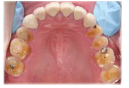 QQ圖片20150803123024.png QQ圖片20150803123024.png