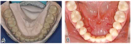 QQ圖片20150803123225.png QQ圖片20150803123225.png