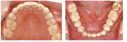 QQ圖片20150803123256.png QQ圖片20150803123256.png