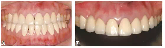 QQ圖片20150803123310.png QQ圖片20150803123310.png