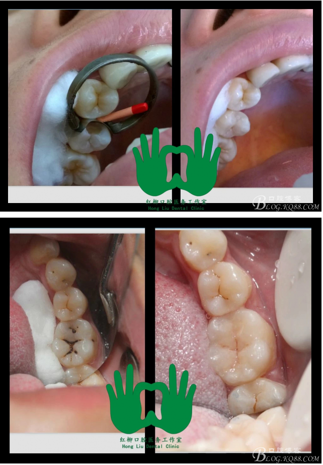 QQ圖片20150814112551.png QQ圖片20150814112551.png