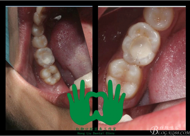 QQ圖片20150814112619.png QQ圖片20150814112619.png